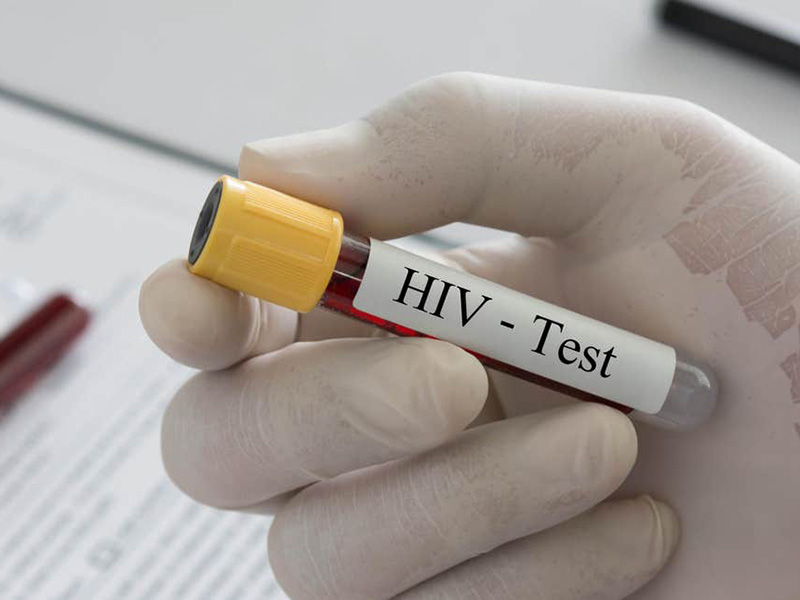 HIV_02